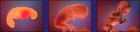 human-embryo.jpeg