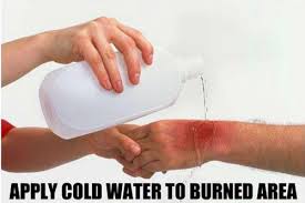 Apply Cold Water To Burned Area | Apply Cold Water To That Burn | Know Your  Meme