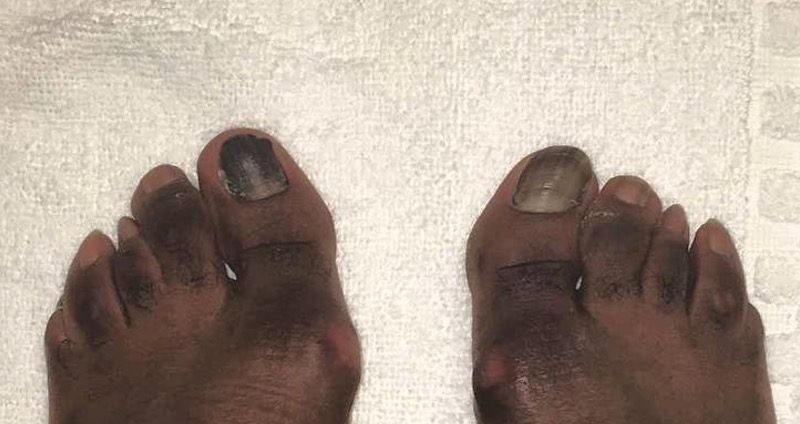adrien-broner-feet-800x424.jpg