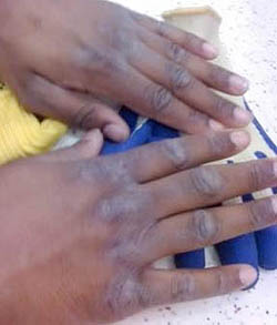 ashyhands.jpg