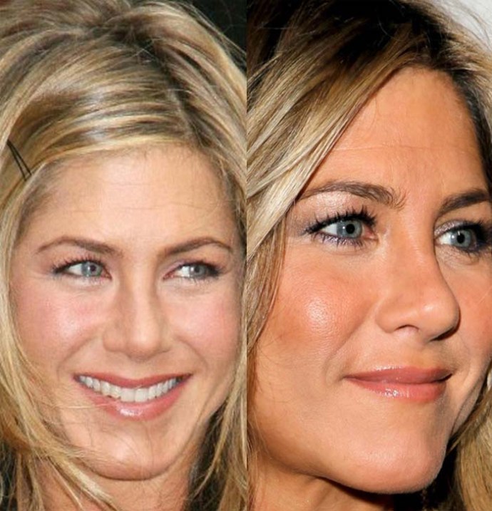 jennifer-aniston-nose-job.jpg