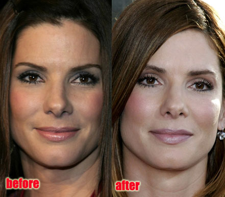 sandra-bullock-before-after-2.jpg