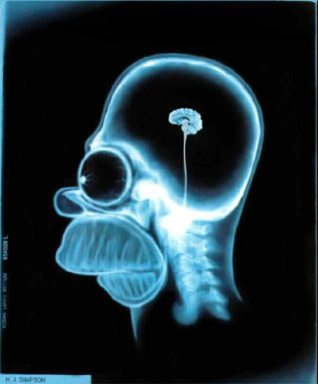 simpbrain.jpg