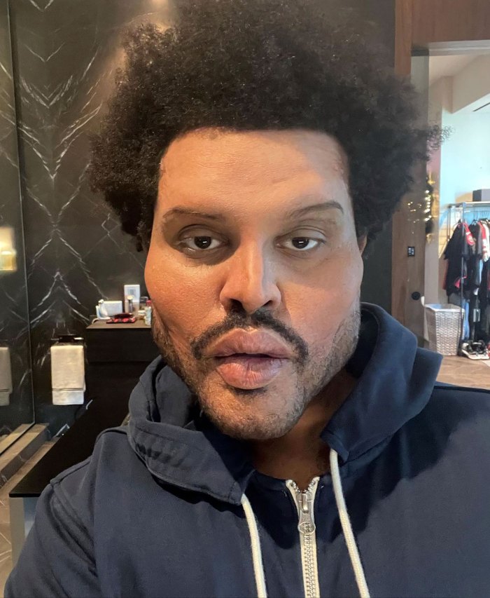 The-Weeknd-Save-Your-Tears-Plastic-Surgery-Look-Is-Prosthetics-Feature.jpg