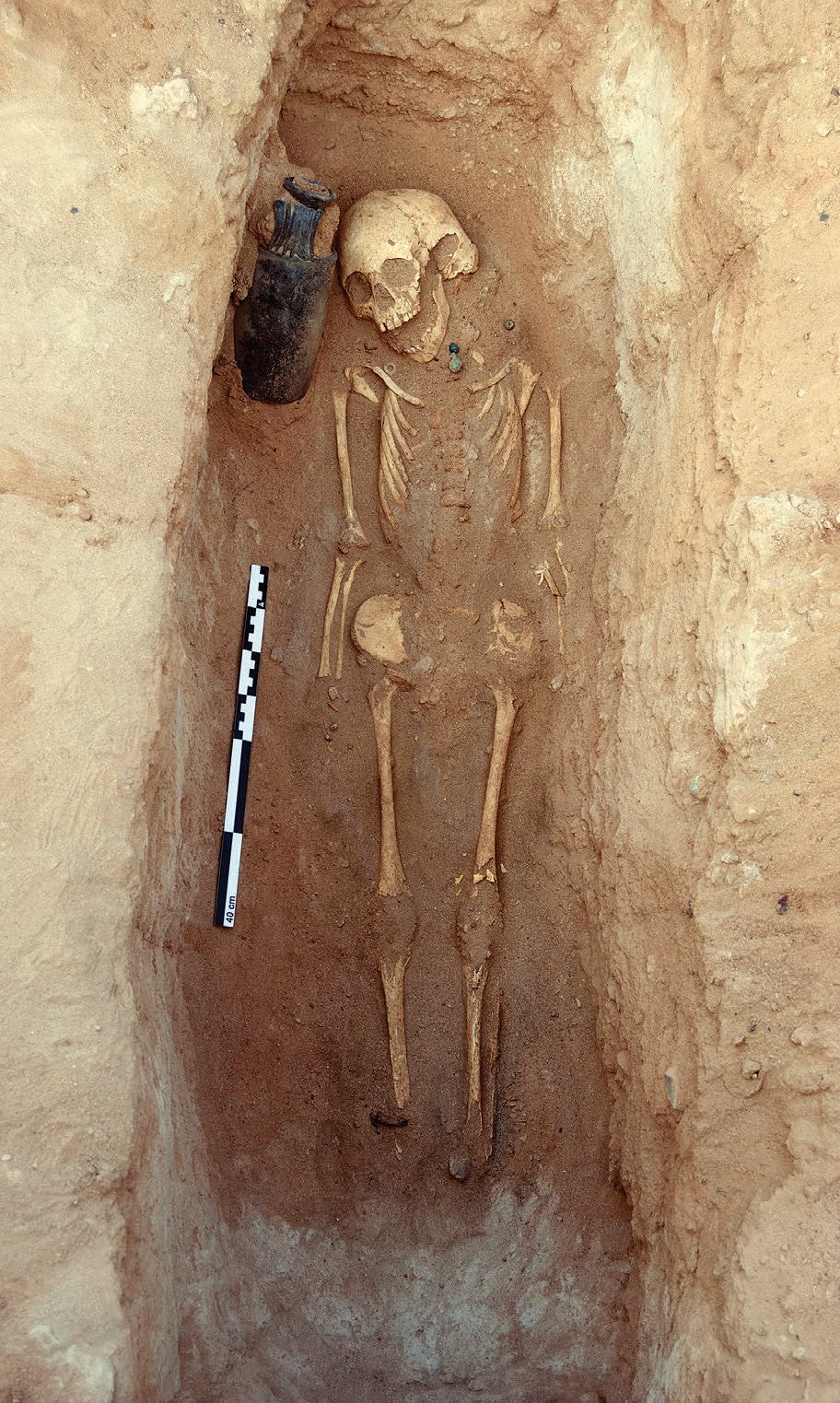 this-is-the-excavated-tomb-of-a-young-somali-child-7-years-v0-8idcb40xo3j91.jpg