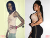 minaj-plastic-surgery1.jpg