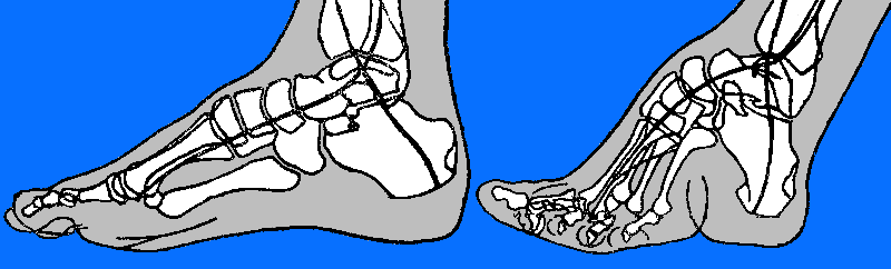 FootBindingRxSchema2.gif