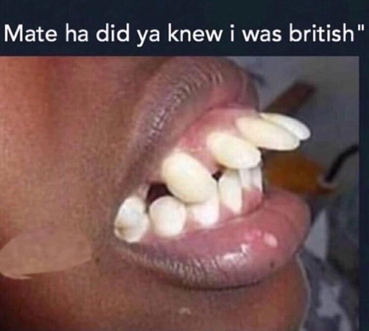 As a British person, the majority of us actually have good teeth : dankmemes