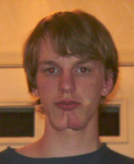 buttchinyb1.jpg