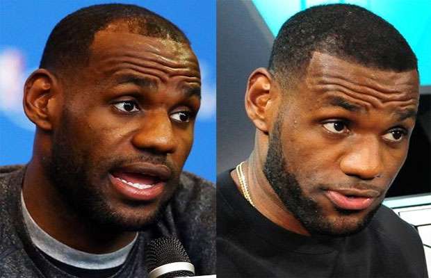 Lebron-James-Hair-Transplant.jpg