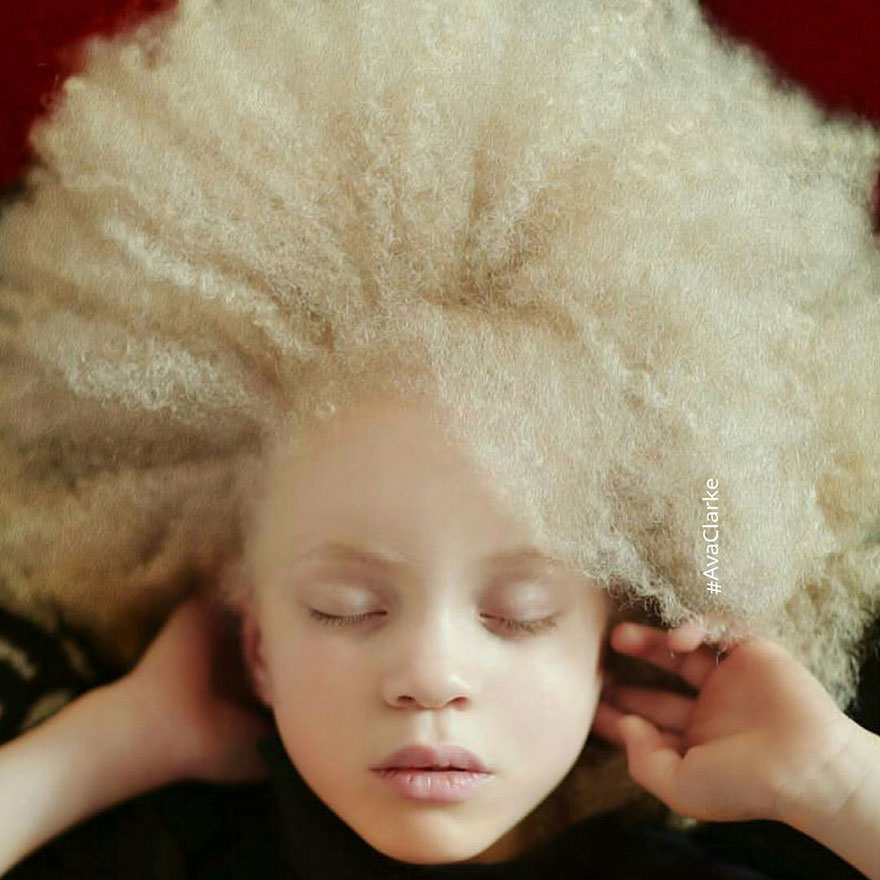 beautiful-albino-people-albinism-46-582f0ea51b8b1__880.jpg