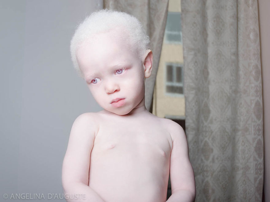 beautiful-albino-people-albinism-52-582f01508ed67__880.jpg